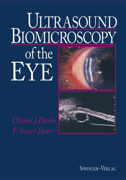 Produktbild: Ultrasound Biomicroscopy of the Eye