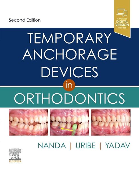 Produktbild: Temporary Anchorage Devices in Orthodontics