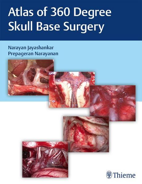 Produktbild: Atlas of 360 Degree Skull Base Surgery