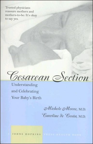 Produktbild: Cesarean Section