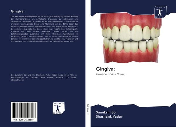Gingiva:, Taschenbuch von Sunakshi Soi , Shashank Yadav, Sciencia Scripts, 9786200923561