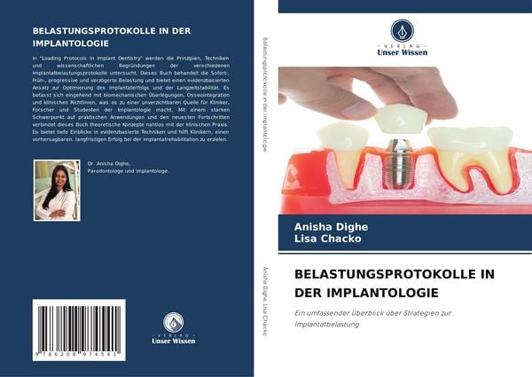 Belastungsprotokolle in der Implantologie, Taschenbuch von Anisha Dighe , Lisa Chacko, Verlag Unser Wissen, 9786208974541