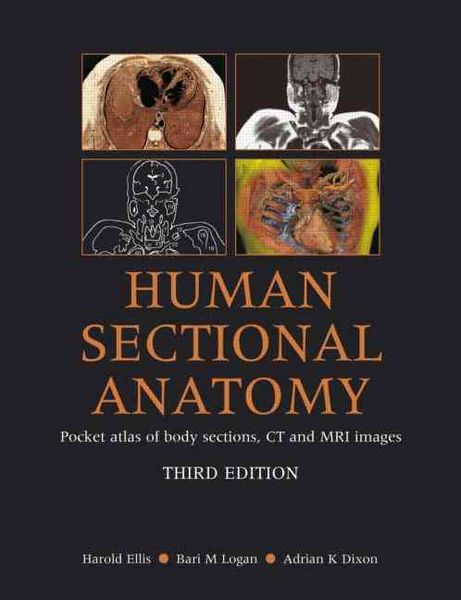 Produktbild: Ellis, H: Human Sectional Anatomy: Pocket Atlas