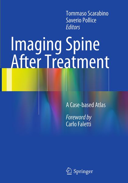 Produktbild: Imaging Spine After Treatment