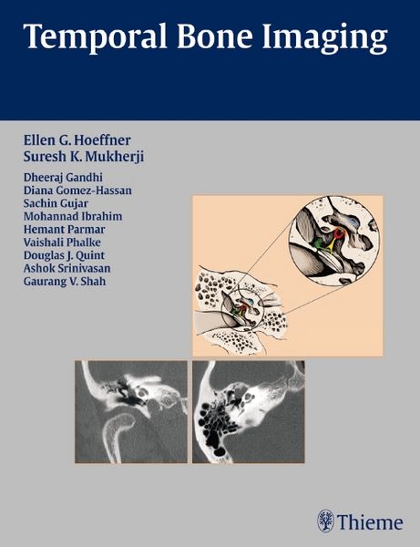 Produktbild: Temporal Bone Imaging