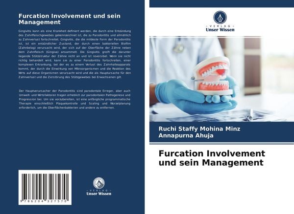 Furcation Involvement und sein Management, Taschenbuch von Ruchi Staffy Mohina Minz , Annapurna Ahuja, Verlag Unser Wissen, 9786204327570