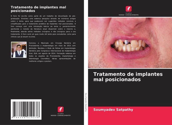 Produktbild: Tratamento de implantes mal posicionados