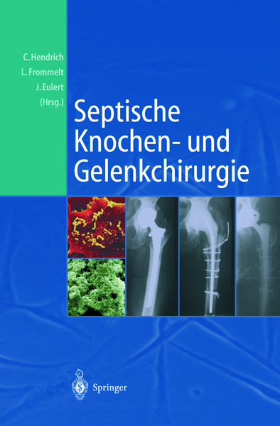 Produktbild: Septische Knochen-und Gelenkchirurgie