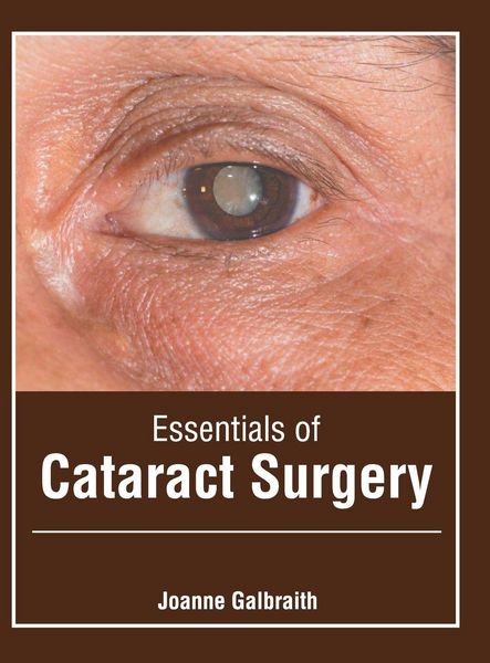 Produktbild: Essentials of Cataract Surgery