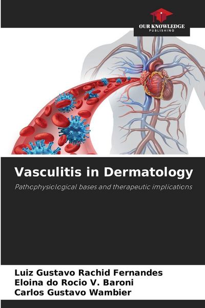 Produktbild: Vasculitis in Dermatology