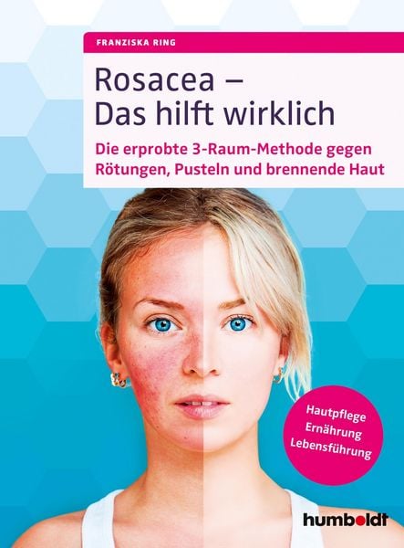 Produktbild: Rosacea - Das hilft wirklich