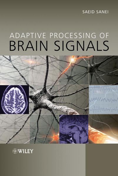 Produktbild: Adaptive Processing of Brain Signals