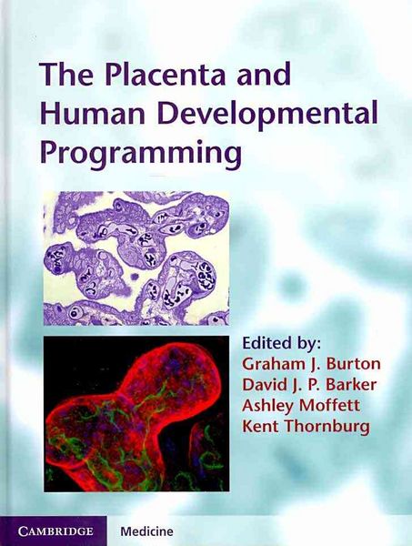 Produktbild: The Placenta and Human Developmental Programming