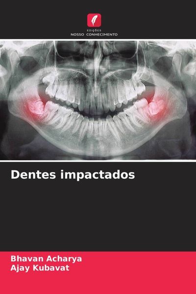 Produktbild: Dentes impactados