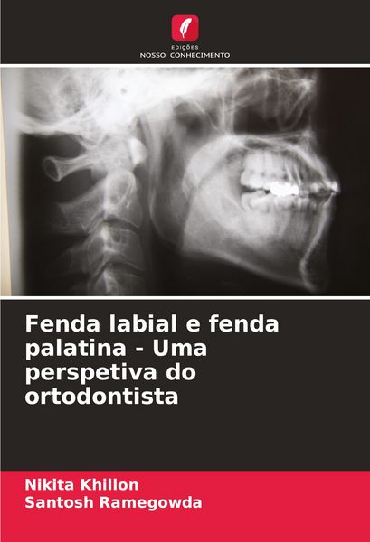 Produktbild: Fenda labial e fenda palatina - Uma perspetiva do ortodontista