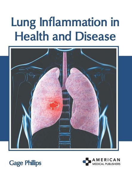 Produktbild: Lung Inflammation in Health and Disease