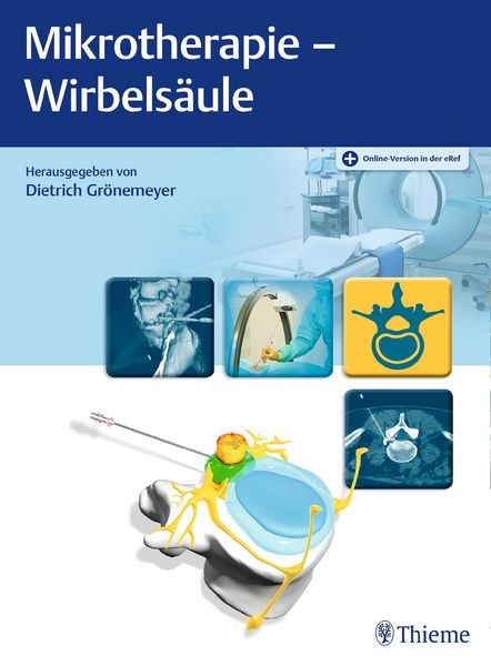 Produktbild: Mikrotherapie - Wirbels&auml;ule