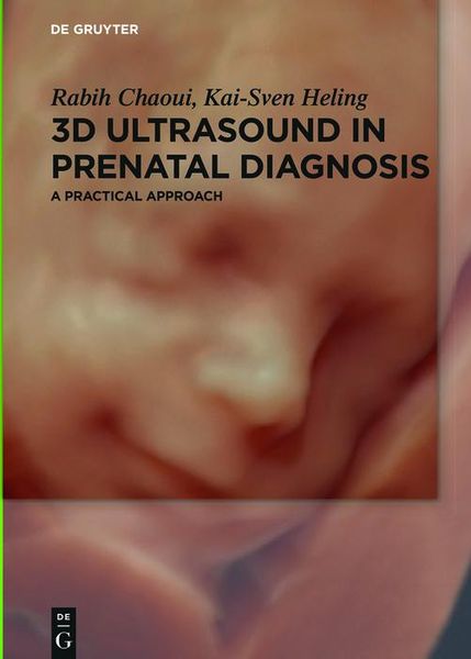 Produktbild: 3D Ultrasound in Prenatal Diagnosis