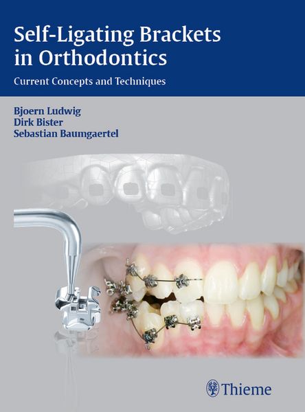 Produktbild: Self-Ligating Brackets in Orthodontics