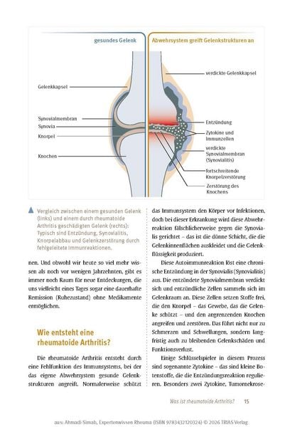 Produktbild: Expertenwissen: Rheuma