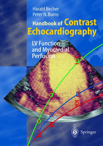Produktbild: Handbook of Contrast Echocardiography