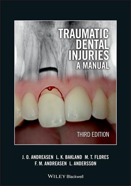Produktbild: Traumatic Dental Injuries