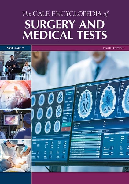 Produktbild: Gale Encyclopedia of Surgery and Medical Tests