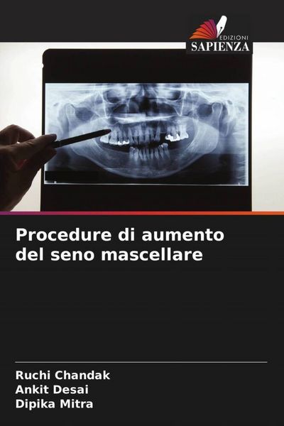 Produktbild: Procedure di aumento del seno mascellare