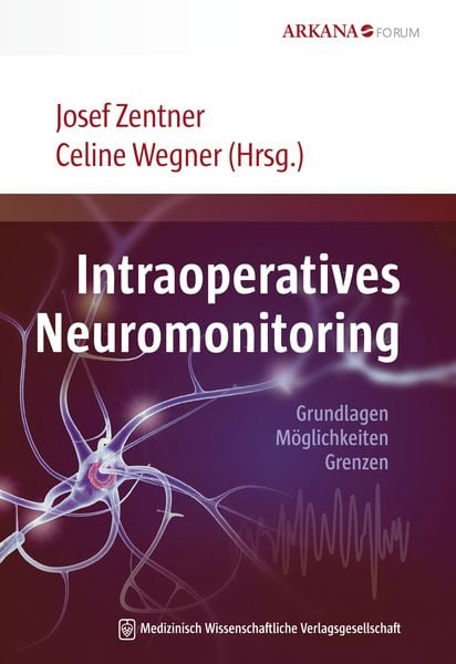 Produktbild: Intraoperatives Neuromonitoring
