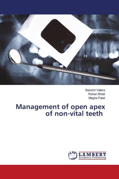 Produktbild: Management of open apex of non-vital teeth