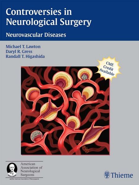 Produktbild: Controversies in Neurological Surgery