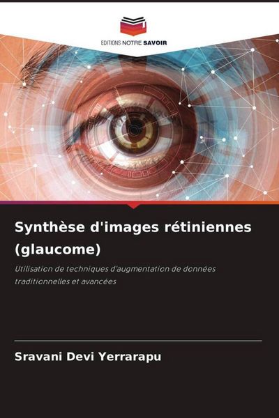 Produktbild: Synth&egrave;se d'images r&eacute;tiniennes (glaucome)