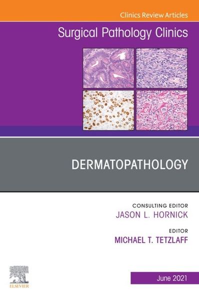 Produktbild: Dermatopathology, An Issue of Surgical Pathology Clinics,E-Book