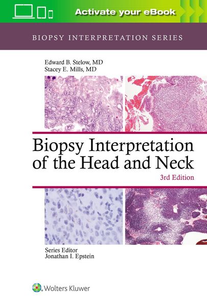 Produktbild: Biopsy Interpretation of the Head and Neck
