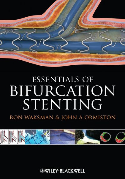 Produktbild: Bifurcation Stenting