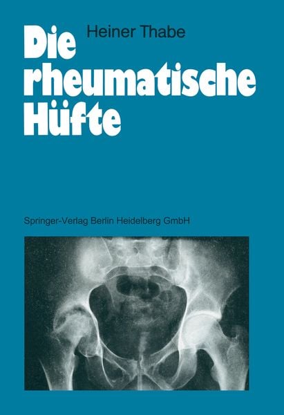 Die rheumatische Hüfte, Taschenbuch von Heiner Thabe, Springer Berlin, 9783540500797