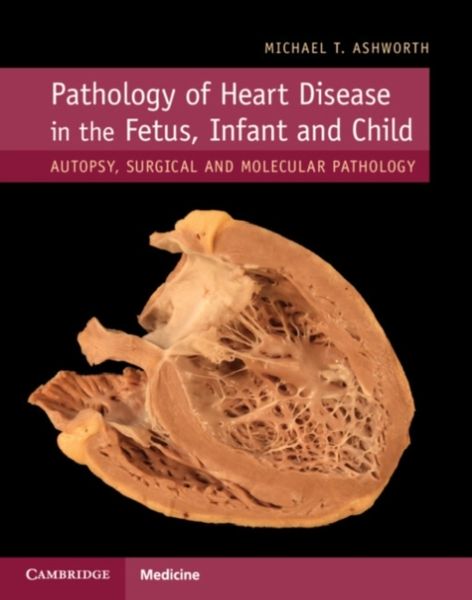 Produktbild: Pathology of Heart Disease in the Fetus, Infant and Child