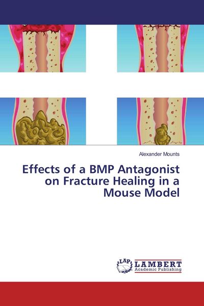 Produktbild: Effects of a BMP Antagonist on Fracture Healing in a Mouse Model