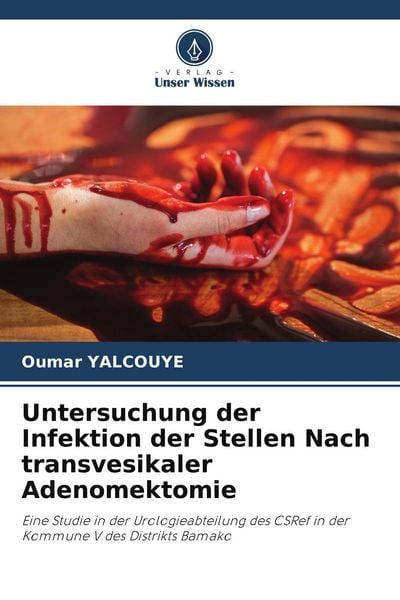 Produktbild: Untersuchung der Infektion der Stellen Nach transvesikaler Adenomektomie