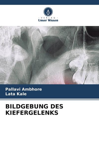 Bildgebung des Kiefergelenks, Taschenbuch von Pallavi Ambhore , Lata Kale, Verlag Unser Wissen, 9786204636580