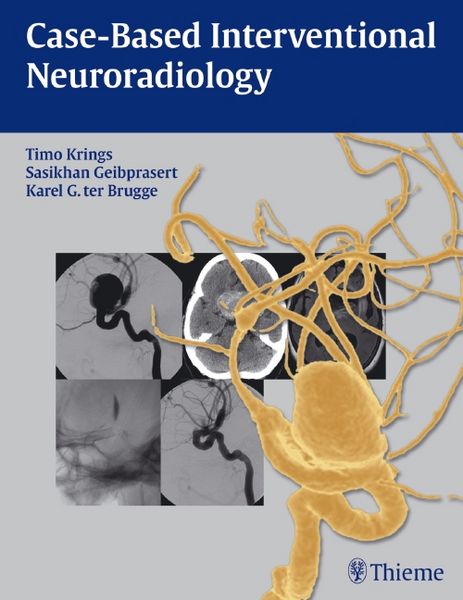 Produktbild: Case-Based Interventional Neuroradiology
