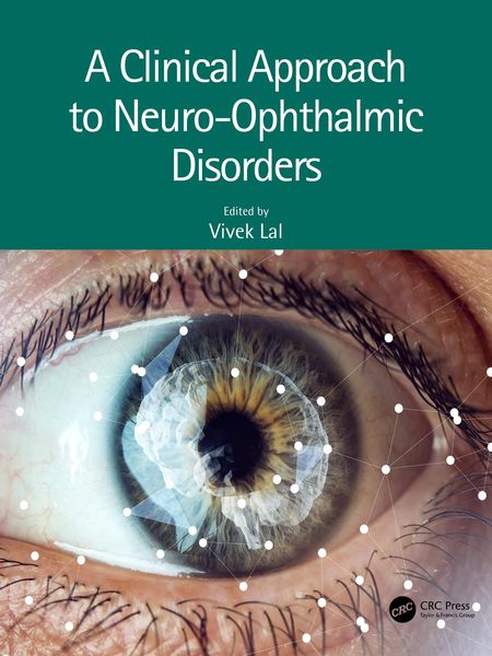 Produktbild: A Clinical Approach to Neuro-Ophthalmic Disorders