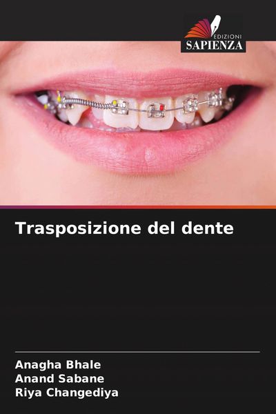 Produktbild: Trasposizione del dente