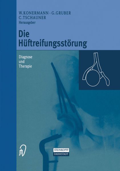 Produktbild: Die H&uuml;ftreifungsst&ouml;rung