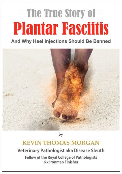 Produktbild: The True Story of Plantar Fasciitis: And Why Heel Injections Should Be Banned