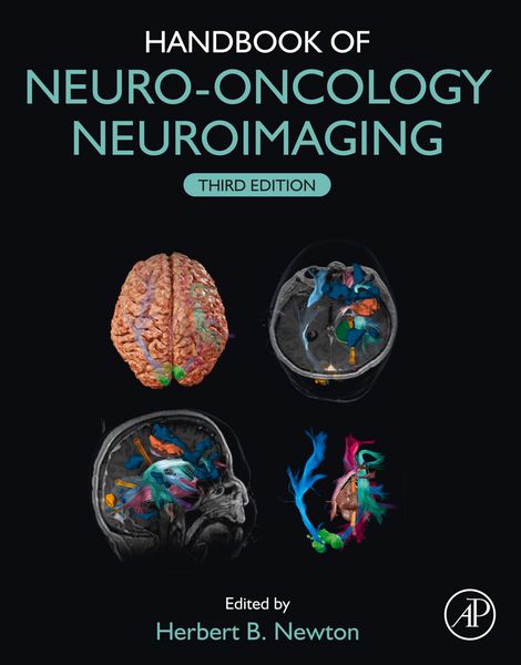 Produktbild: Handbook of Neuro-Oncology Neuroimaging