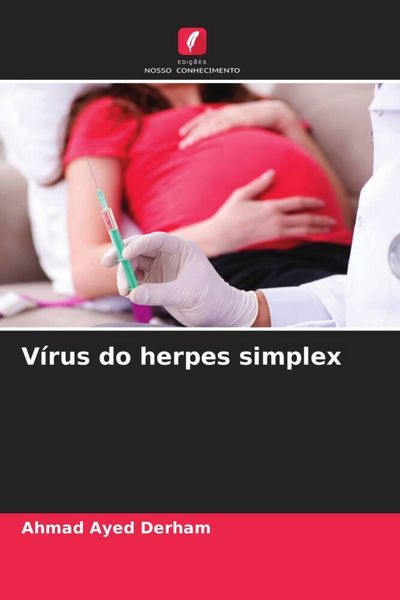 Produktbild: V&iacute;rus do herpes simplex