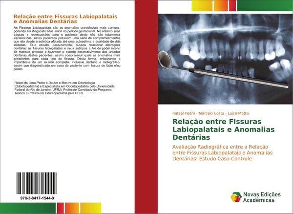 Produktbild: Rela&ccedil;&atilde;o entre Fissuras Labiopalatais e Anomalias Dent&aacute;rias