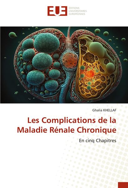 Produktbild: Les Complications de la Maladie R&eacute;nale Chronique