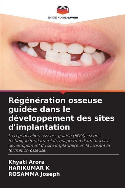 Produktbild: R&eacute;g&eacute;n&eacute;ration osseuse guid&eacute;e dans le d&eacute;veloppement des sites d'implantation